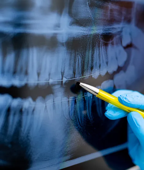 Digital X-Rays